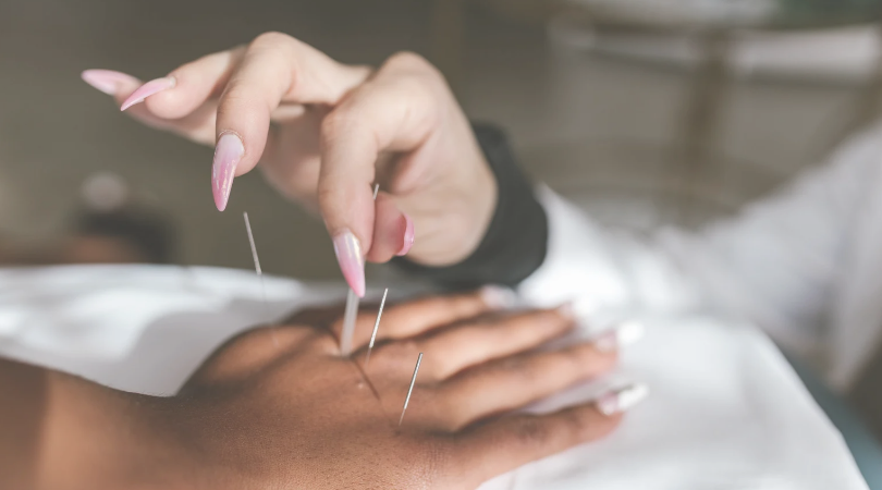 Needles acupuncture 