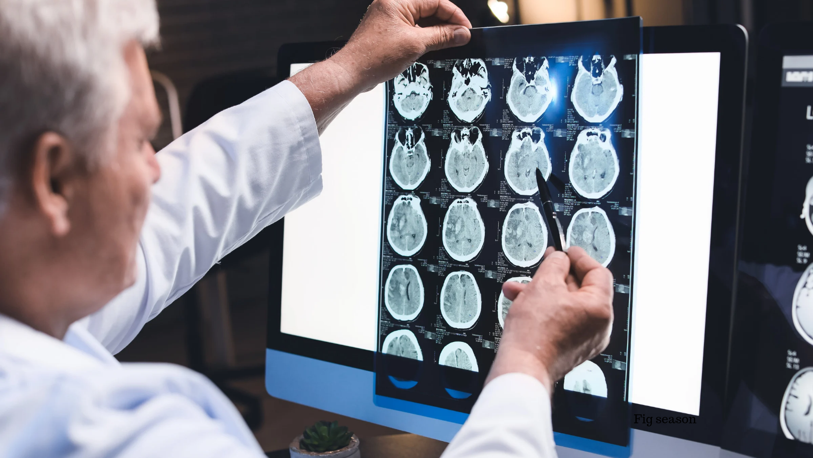 Physical Therapy Guide: Effective Strategies for Concussion Recovery