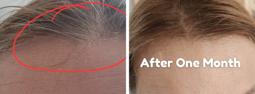 MDHair Before and After