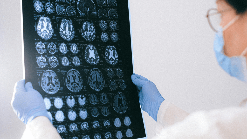 Why Neuroscience Nursing Is the Next Big Thing