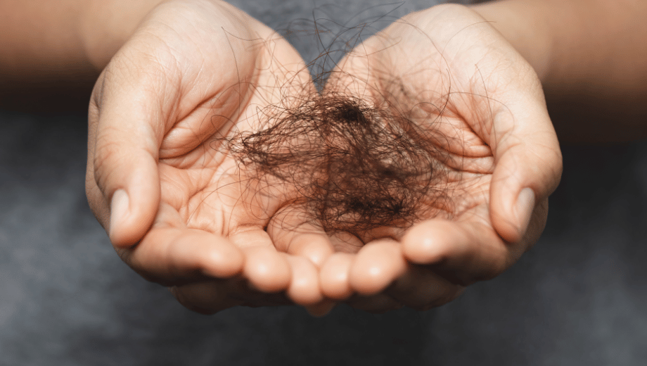 Understanding The Most Common Causes Of Hair Loss In Adults