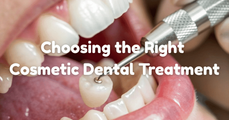 Choosing the Right Cosmetic Dental Treatment: A How-to Guide