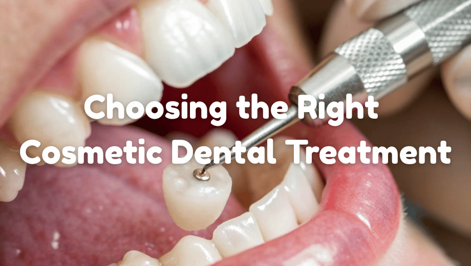 Choosing the Right Cosmetic Dental Treatment: A How-to Guide