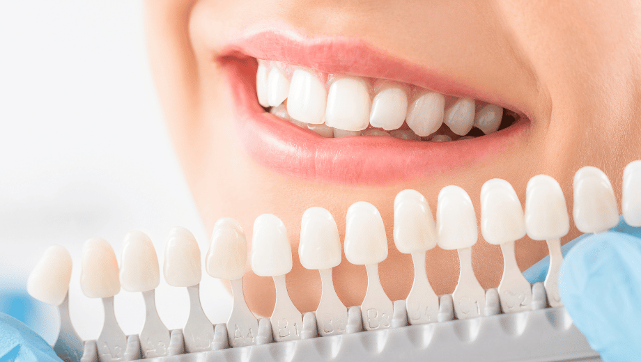Is Teeth Whitening Safe for Sensitive Teeth?