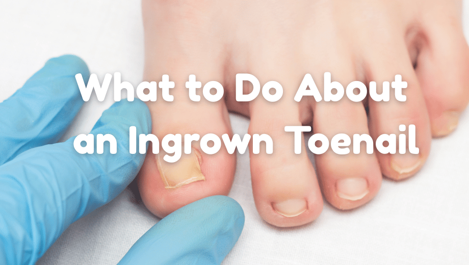 Foot Health: What to Do About an Ingrown Toenail