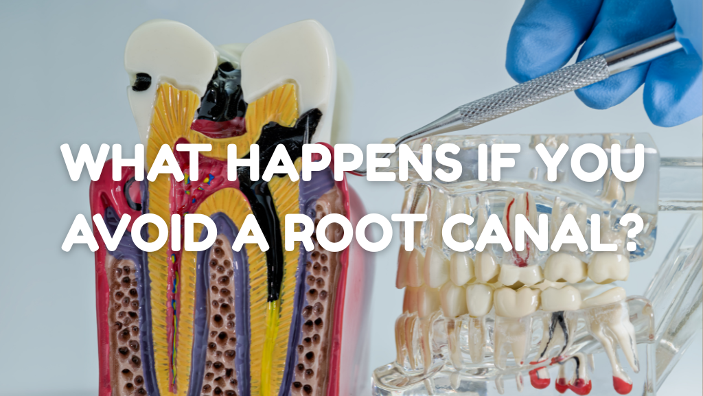 What Happens If You Delay or Avoid a Root Canal? 6 Scenarios
