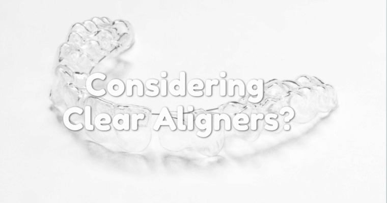 Considering Clear Aligners? Explore These Alternative Options First