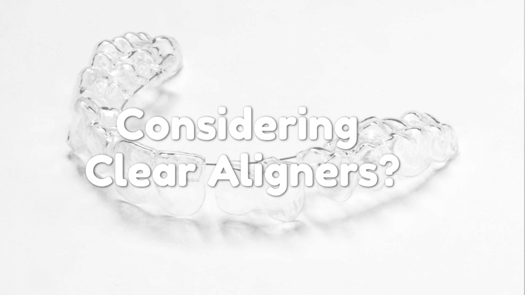 Considering Clear Aligners? Explore These Alternative Options First