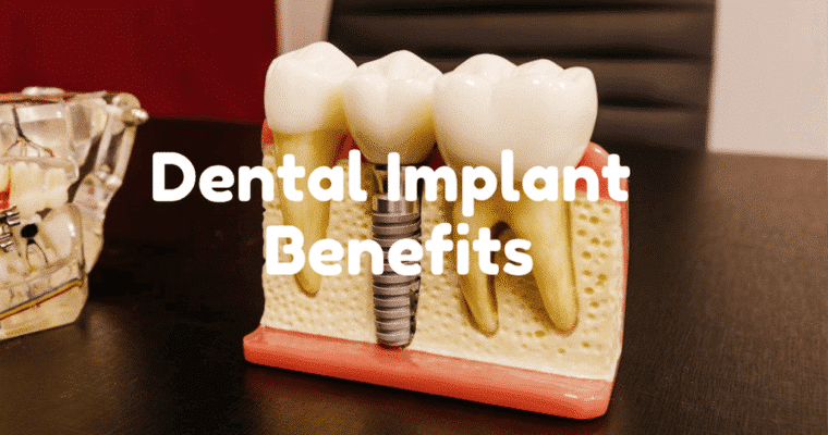 Unexpected Benefits You’ll Get From Dental Implants