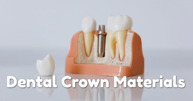 Different Dental Crown Materials and How to Choose the Right One