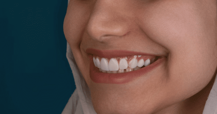 How to Choose the Right Cosmetic Dentist in Bonita Springs