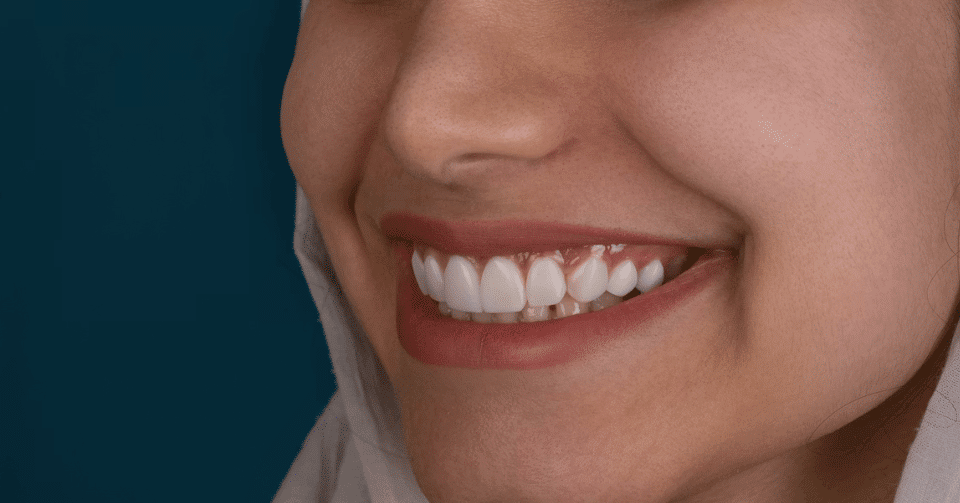 How to Choose the Right Cosmetic Dentist in Bonita Springs