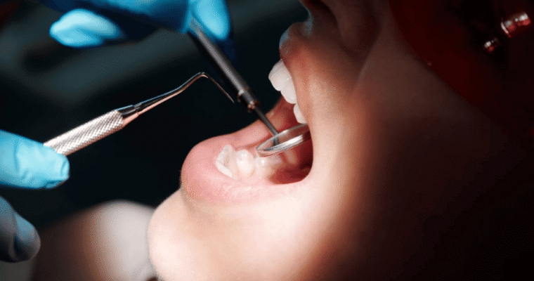 What Happens During a Dental Crown Procedure