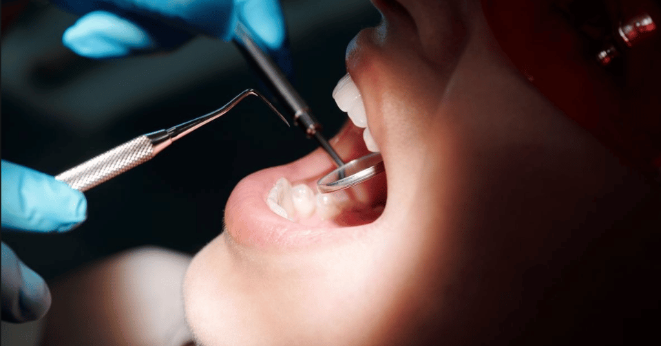 What Happens During a Dental Crown Procedure
