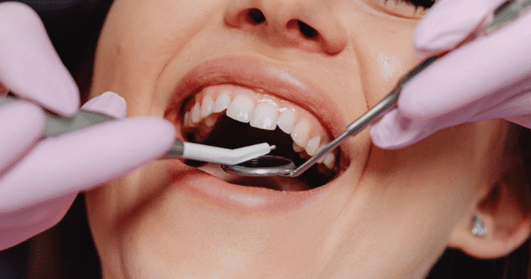 What to Expect During Full Mouth Dental Implant Surgery
