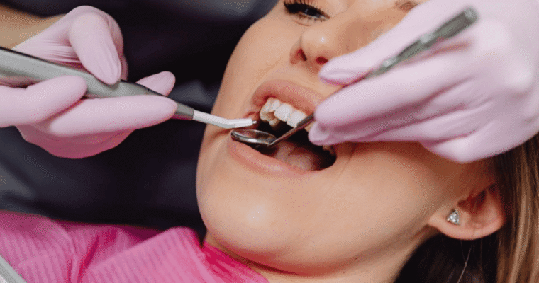 Professional Teeth Whitening Cost