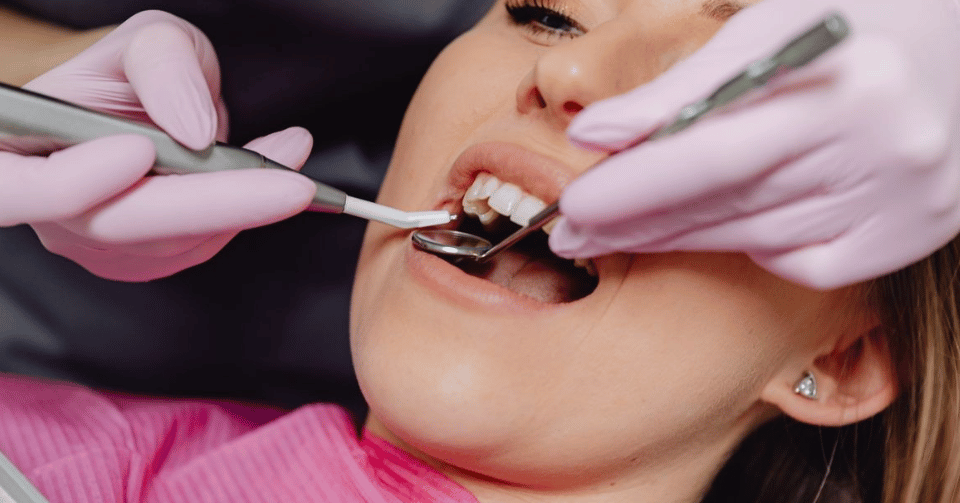 How Much Does Professional Teeth Whitening Really Cost?