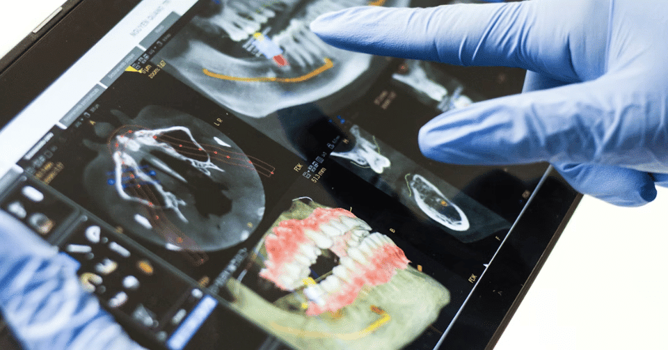 Am I a Good Candidate for Dental Implants? Key Health and Evaluation Factors