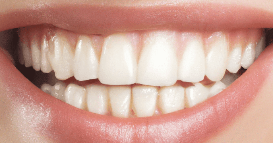 How Cosmetic Dentistry in Atlanta Can Transform Your Smile