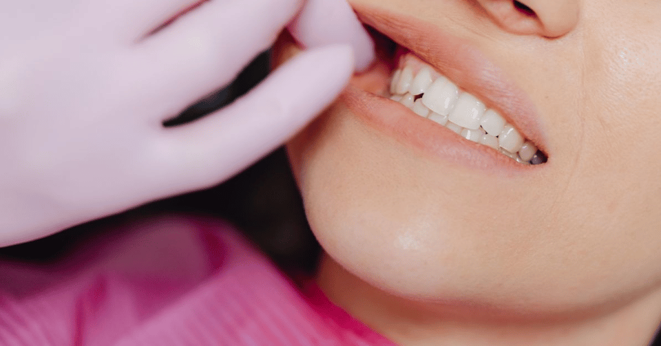 How Cosmetic Dentistry Can Improve Your Confidence at Work
