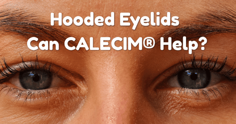Can You Tighten Hooded Eyelids Without Surgery? How can CALECIM® help?