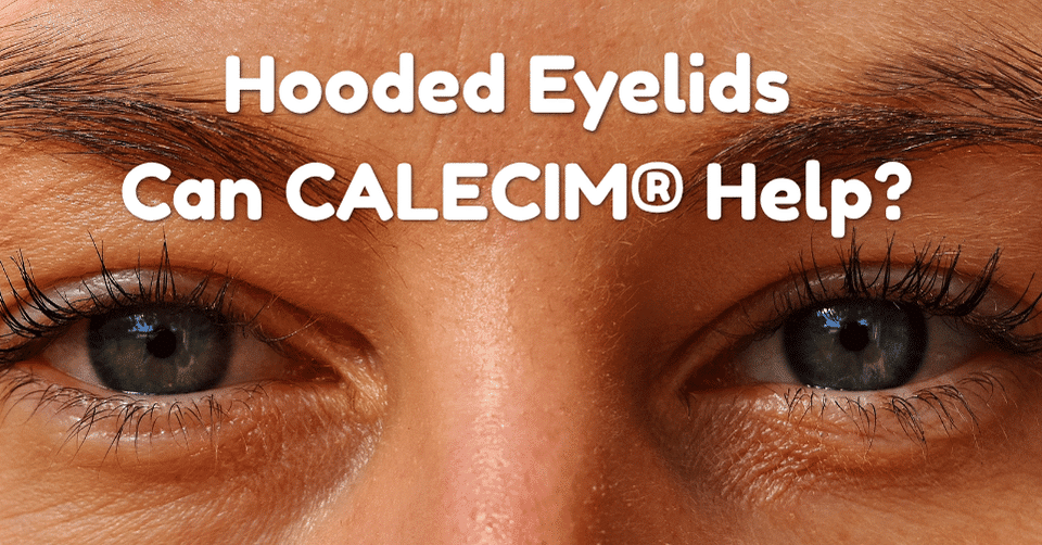 Can You Tighten Hooded Eyelids Without Surgery? How can CALECIM® help?