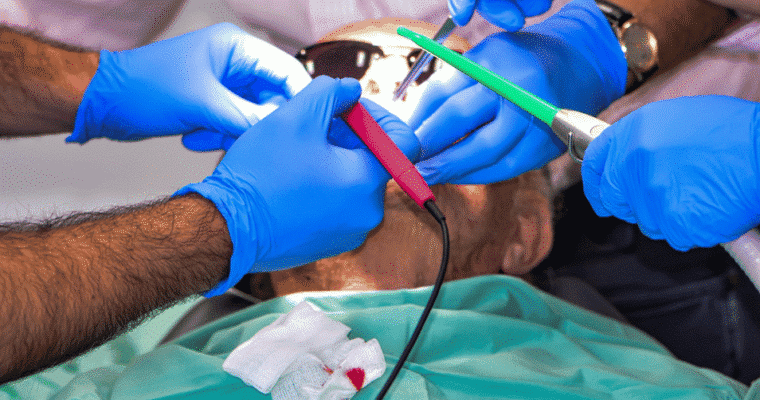 What to Eat After Oral Surgery Without Slowing Healing