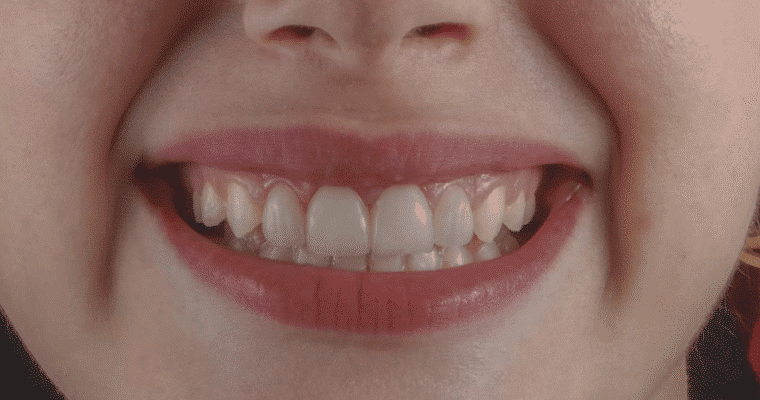 Why Periodontal Health Matters for Teeth and Gums