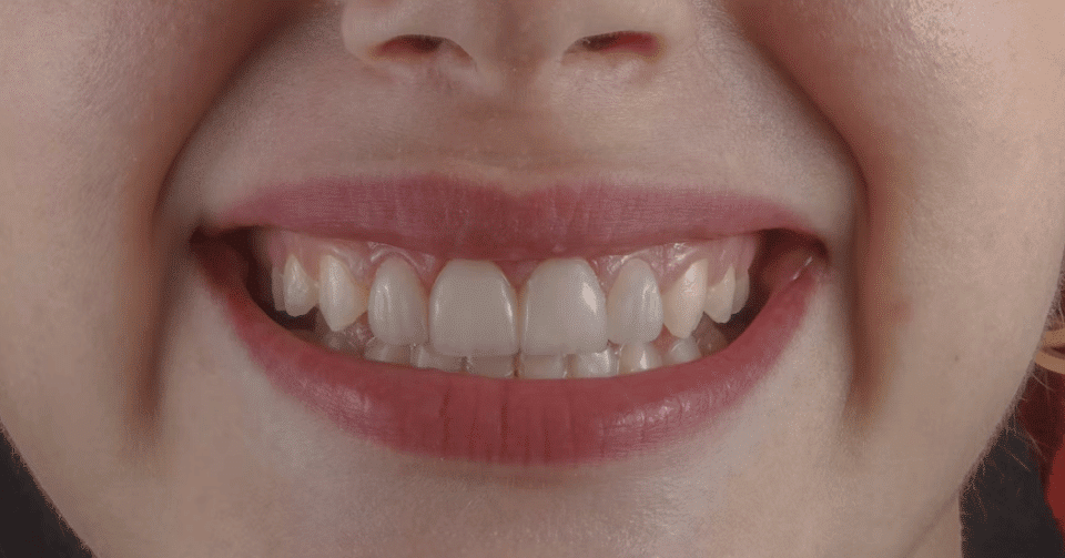Why Periodontal Health Matters for Teeth and Gums