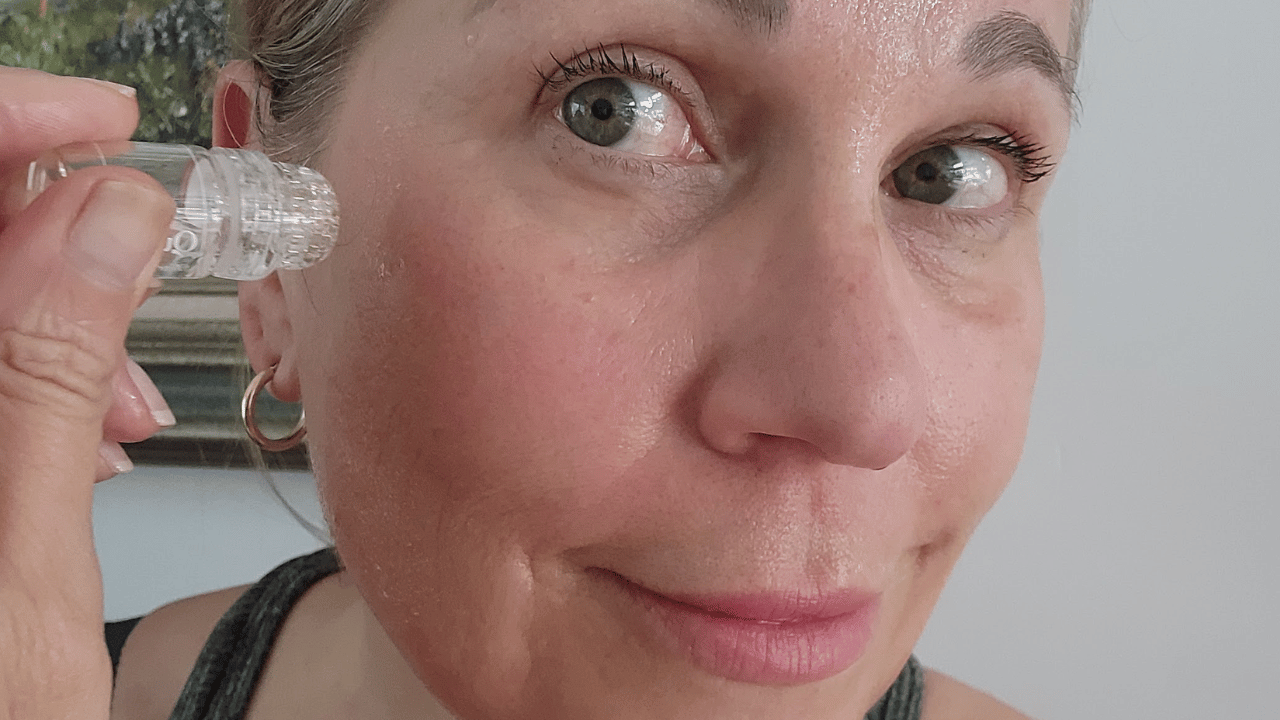 The Qure Micro-Needling leaves skin plump and tightened immediately after a treatment.